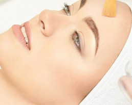 chemical peels medical spa services